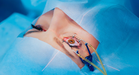 Katarakt Ameliyatı Bunama Riskini Azaltabilir... Katarakt Ameliyatı Bunama Riskini Azaltabilir...